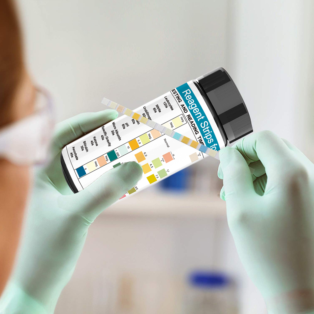100 полосок, тест-полоска для  – обзор и цена Urinalysis Reagent Strip